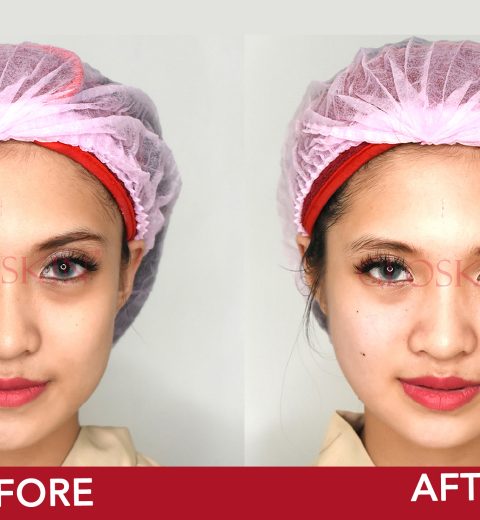 Yuk Ladies, 3 Rekomendasi Klinik Kecantikan di Surabaya